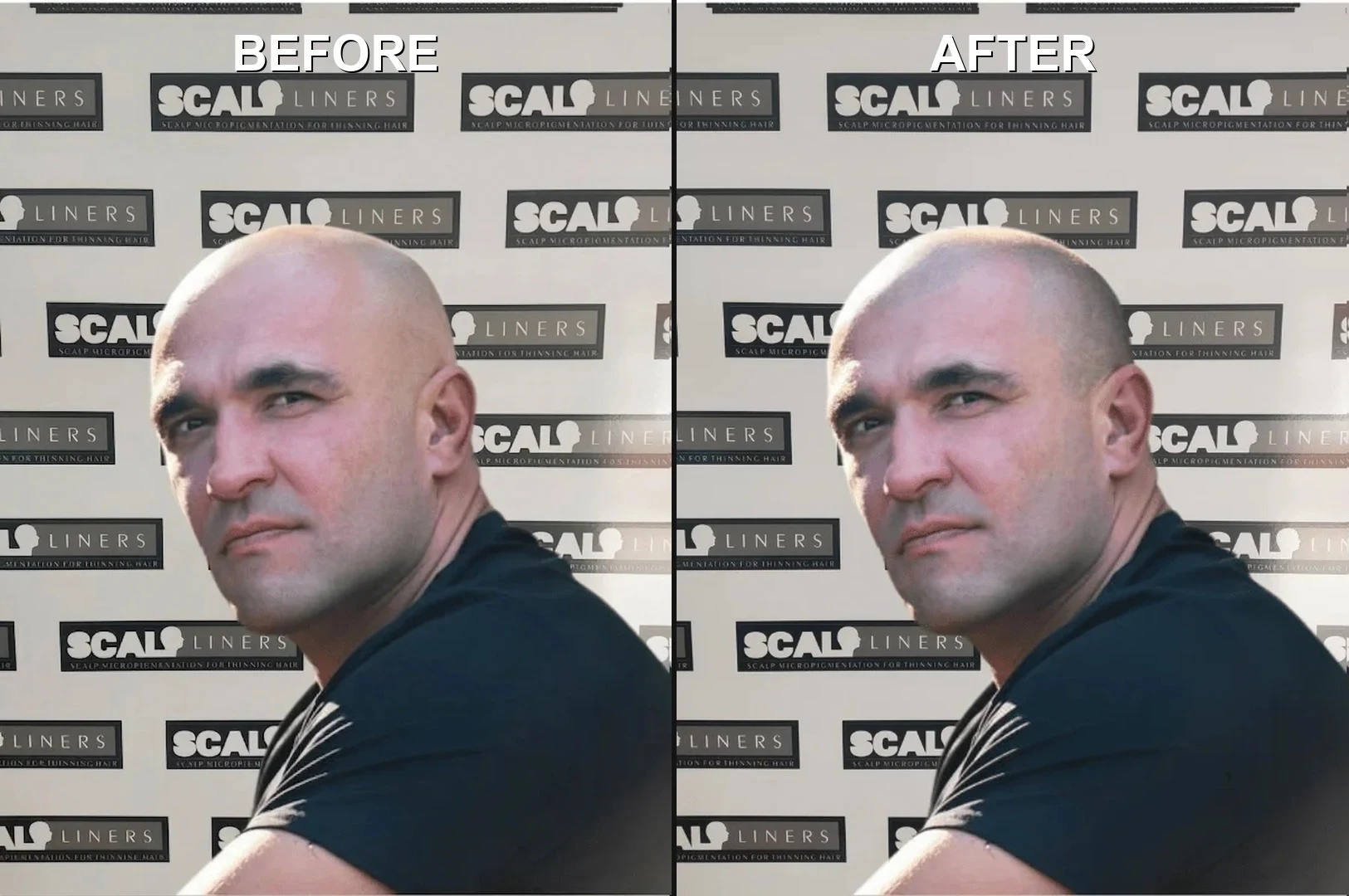 sammy before after