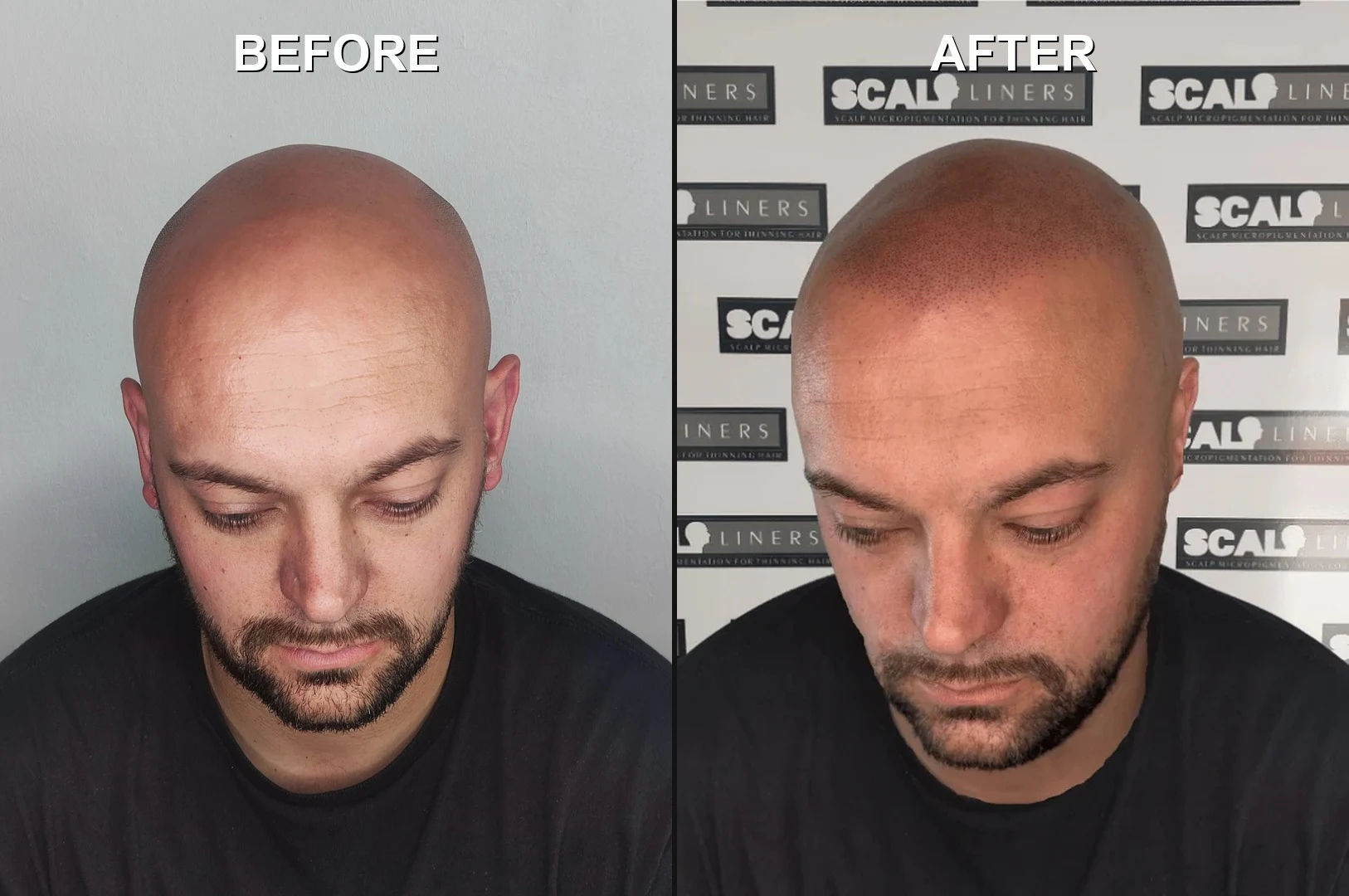Gary Client befoe then after