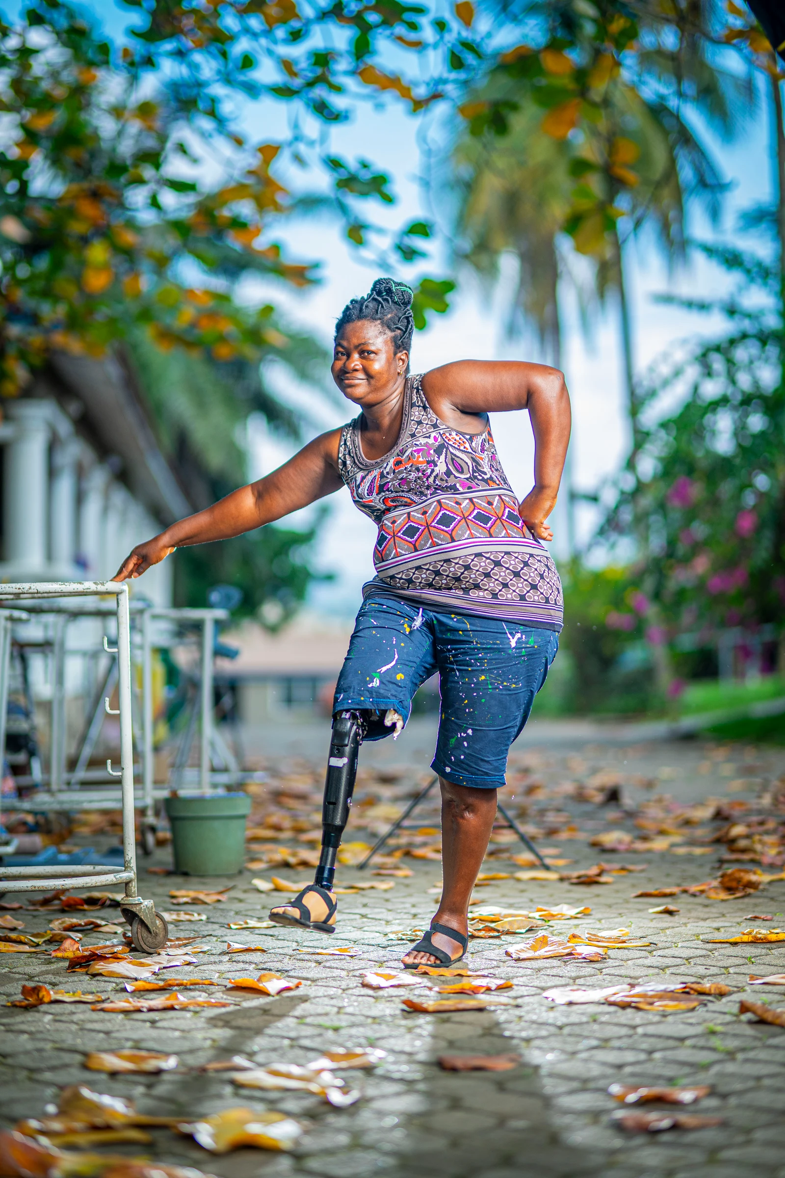 STAND and Nav’Solidaire’s work helps amputees like Rose by providing prosthetic legs and rehabilitation.