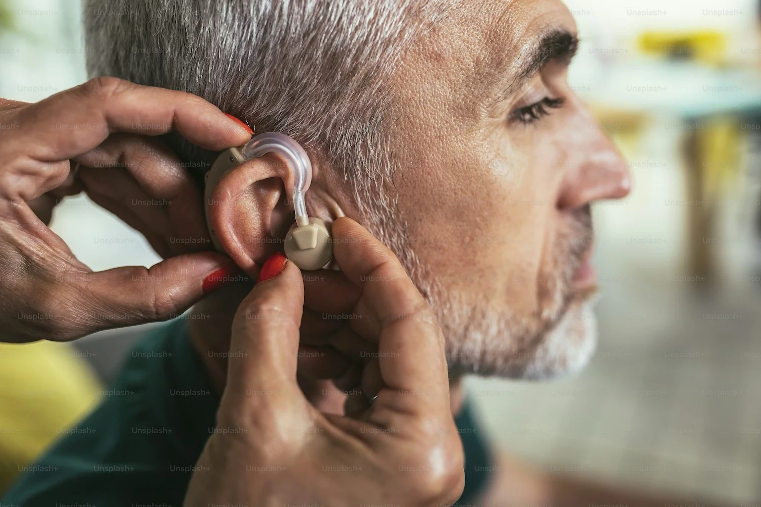 The judgment provides important clarity for veterans seeking assessment and support for military-related hearing loss and tinnitus.